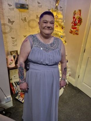 Deficiencia en la atención oncológica para pacientes con discapacidad intelectual