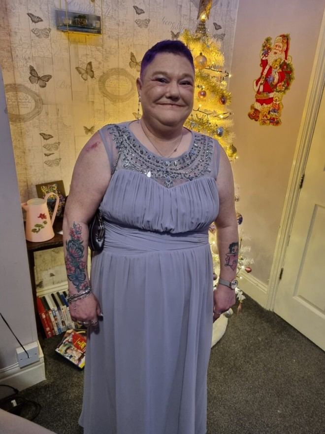 Deficiencia en la atención oncológica para pacientes con discapacidad intelectual