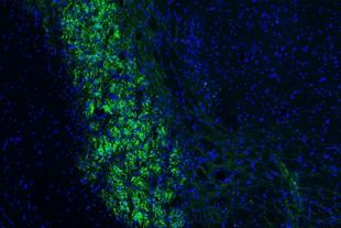 Descubren cómo el cerebro mide distancias usando los bigotes de los roedores