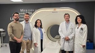 Avances en el diagnóstico del Alzheimer con tomografías PET de tau