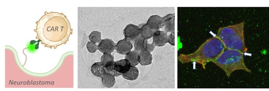 Desarrollan nanopartículas que guían terapias CAR T para combatir tumores infantiles