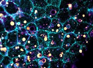 Un nuevo mecanismo mejora la eliminación de células innecesarias en el cuerpo