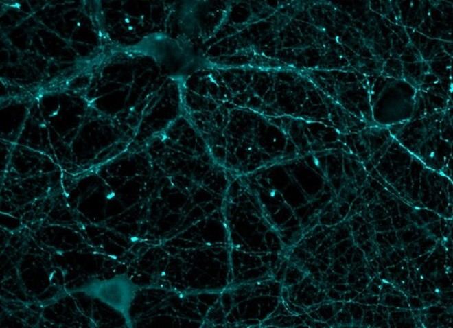 Desarrollan un sensor biológico que mide la actividad de una proteína esencial para la memoria y el corazón