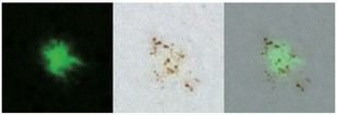Identifican nueva diana terapéutica para el Alzheimer en investigación del IBiS