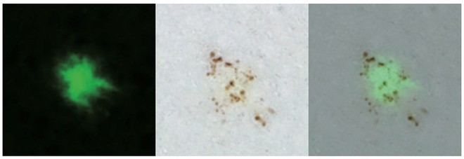 Identifican nueva diana terapéutica para el Alzheimer en investigación del IBiS