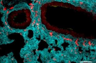 Investigación revela nuevas funciones de los neutrófilos en terapias contra el cáncer e inflamación