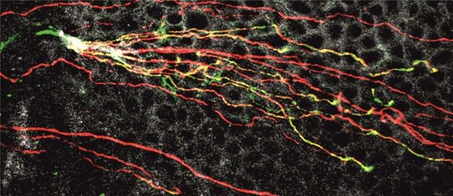 Una nueva molécula activada por luz podría aliviar el dolor ocular en el ojo seco