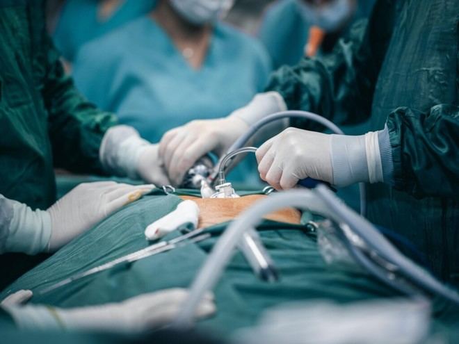 Simulación identifica áreas de mayor riesgo para hernias incisionales en cirugías abdominales