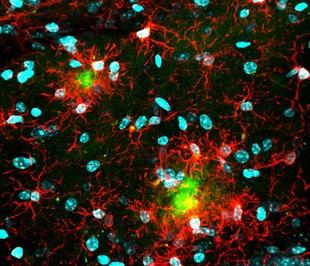 Investigación revela mecanismo inmunitario que aumenta vulnerabilidad de mujeres al Alzheimer