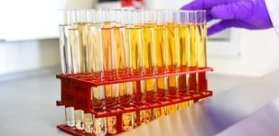 Nuevo test de orina promete detectar cáncer de pulmón antes de que aparezcan síntomas